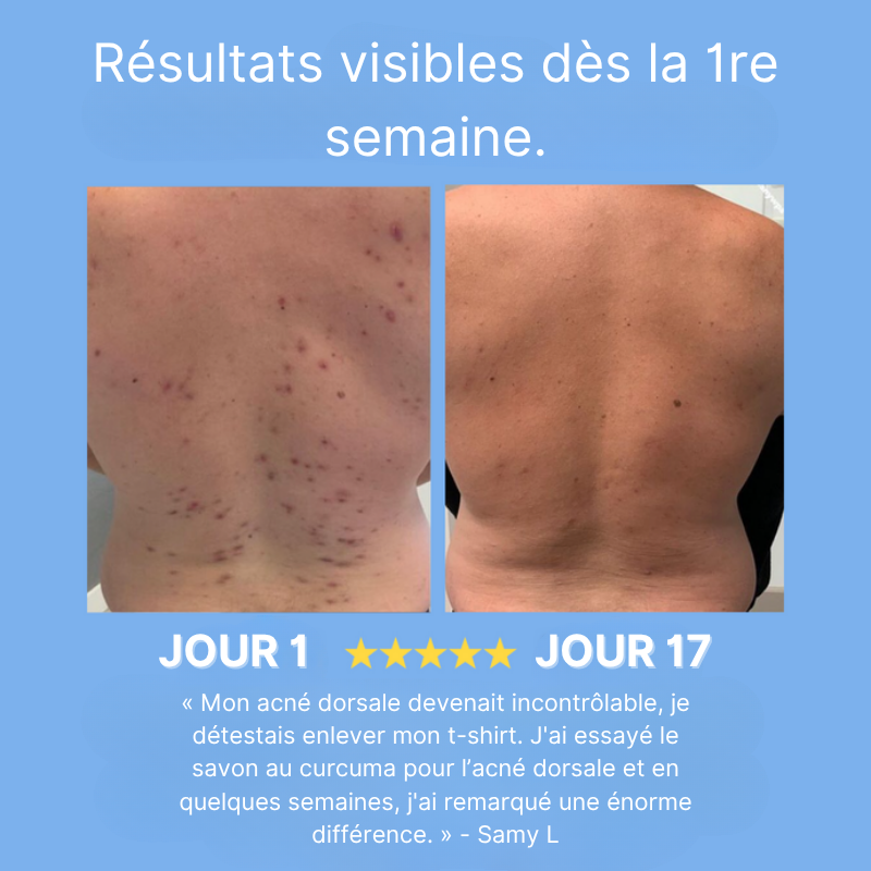 Savon Purifiant Corps Curcuma