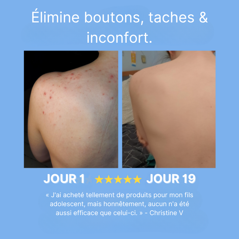 Savon Purifiant Corps Curcuma